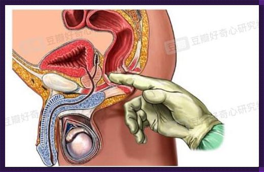 新手怎么前列腺高c 男人吃什么可以养护前列腺?