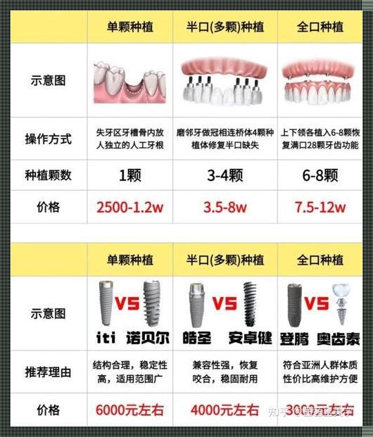 2023年武汉种植牙多少钱一颗？带你揭开价格之谜！