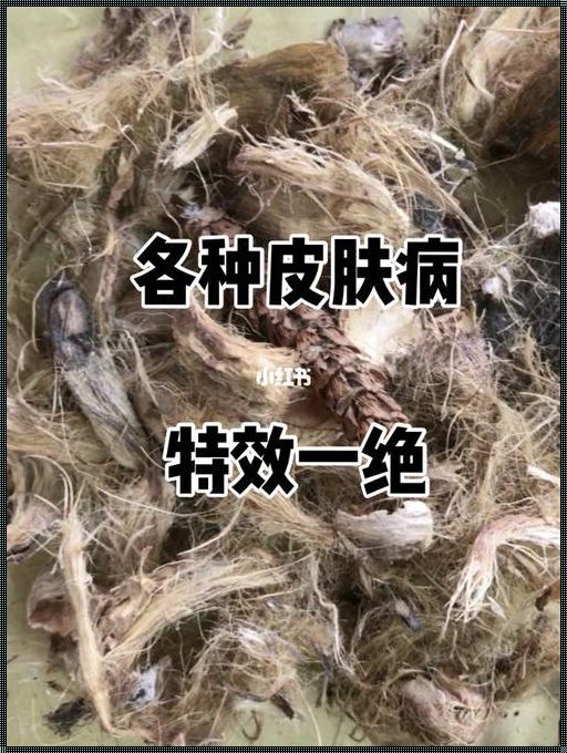 湿疹断根特效秘方：探索中医古方的奇迹