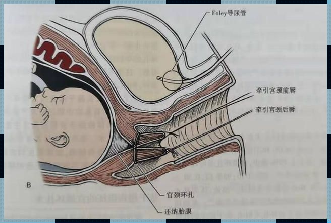 怀孕三个月肚子突然不胀气了：惊喜还是惊吓？