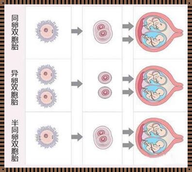 龙凤胎肯定是异卵的吗