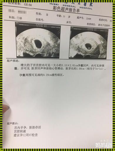 怀孕5周宫腔积液要才能恢复