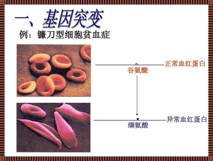 什么是镰刀型红细胞贫血