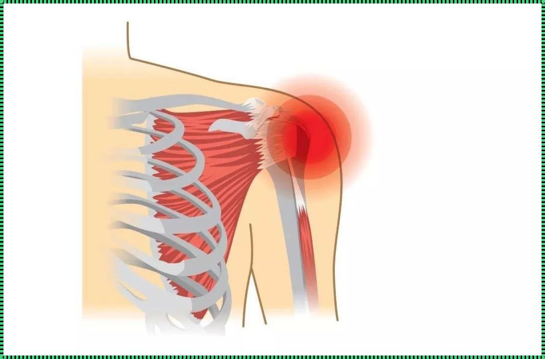 肩周炎疼痛位置图：深入了解疼痛的来源