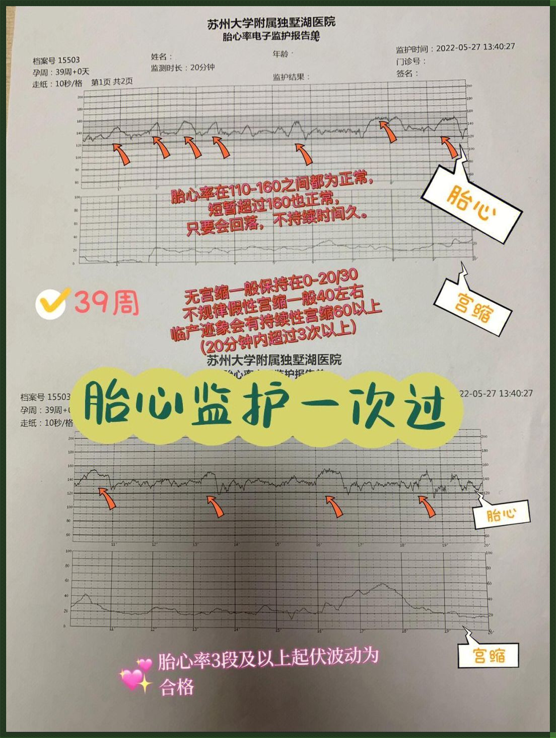 孕39周宫缩五六分钟一次：孕育新生命的关键时刻