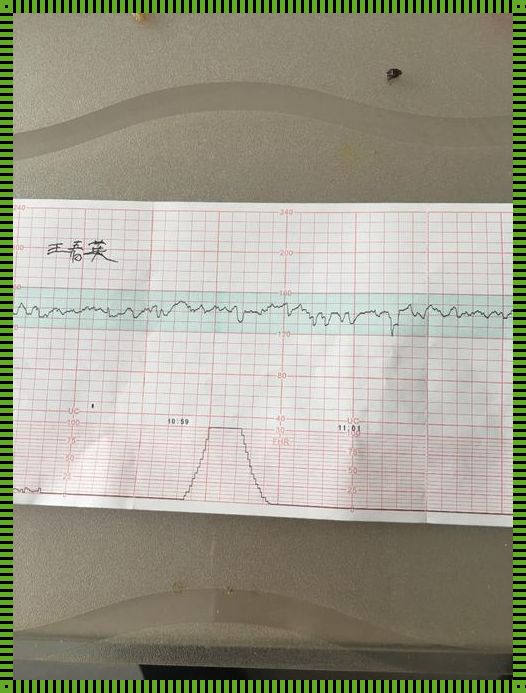 十分钟一次宫缩：一场与时间的赛跑