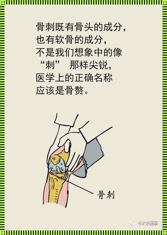 骨刺是什么原因引起的