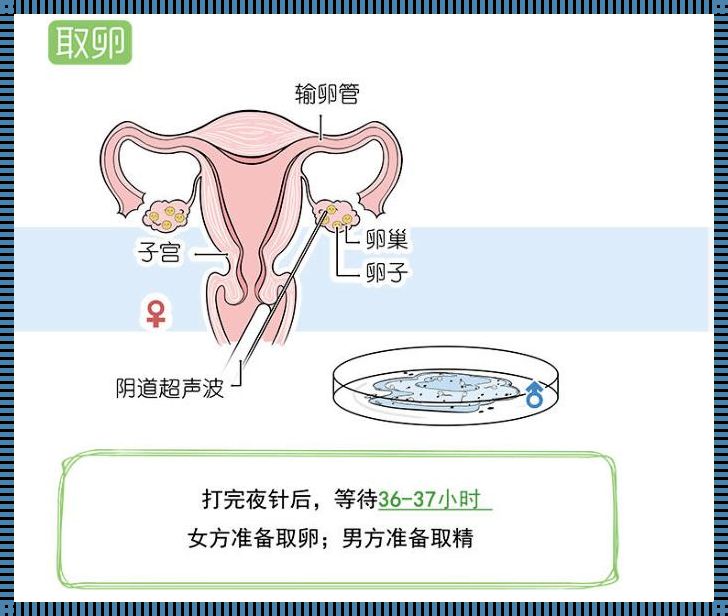 如何保证试管一次成功