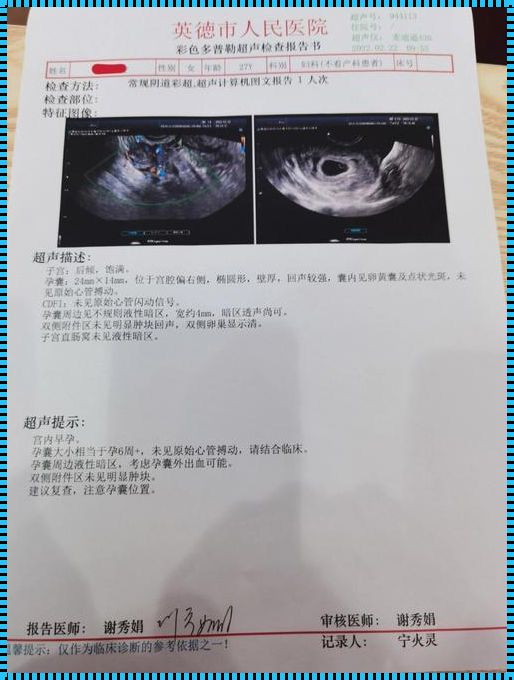 探讨hcg值14万多未见卵黄囊的背后因素