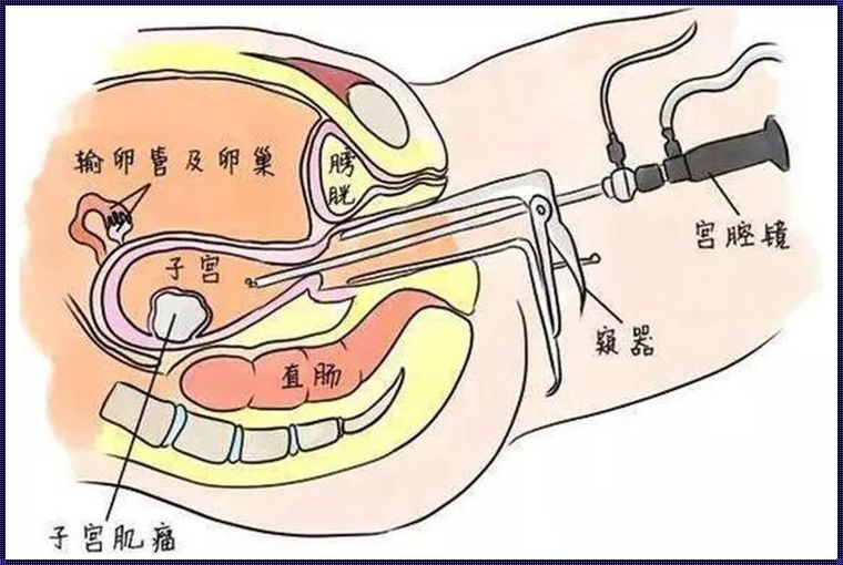 输卵管检查哪种方式最好不伤身体