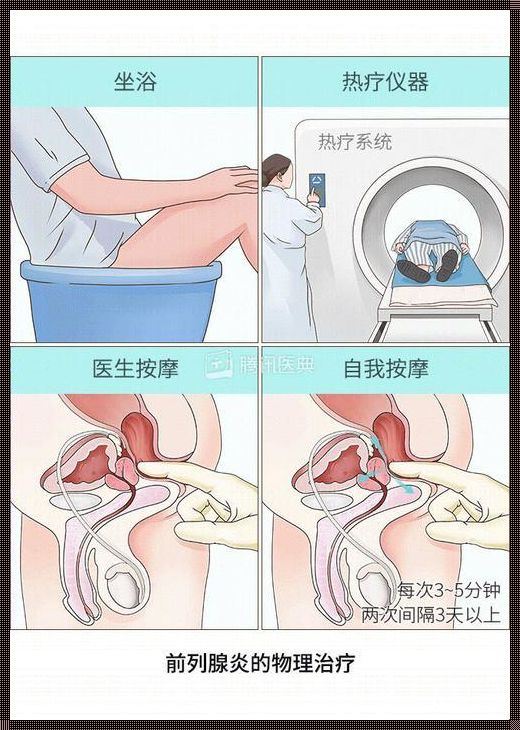 按摩10天治好前列腺炎：一个神奇的治疗故事