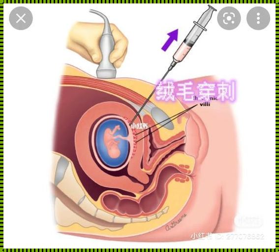 绒穿疼还是羊穿疼：一场寻找真知的探讨