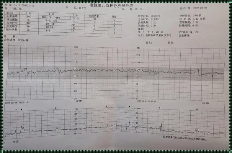 胎监不合格胎儿就有问题吗？