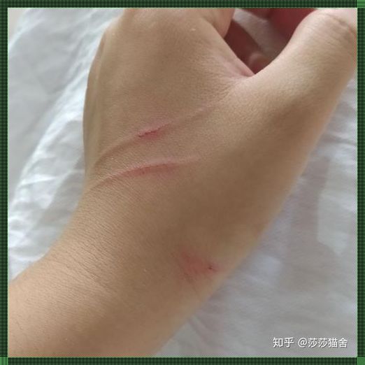 被猫舍的猫抓伤轻微出血：爱与痛的边缘