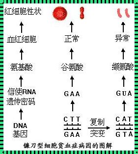 镰刀型细胞贫血症：遗传的锁链与生命的抗争