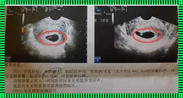 怀孕7周，揭秘男女小技巧的休闲之旅