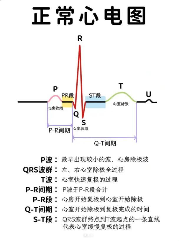 心电图那些事儿：笑看人间“电图”百态