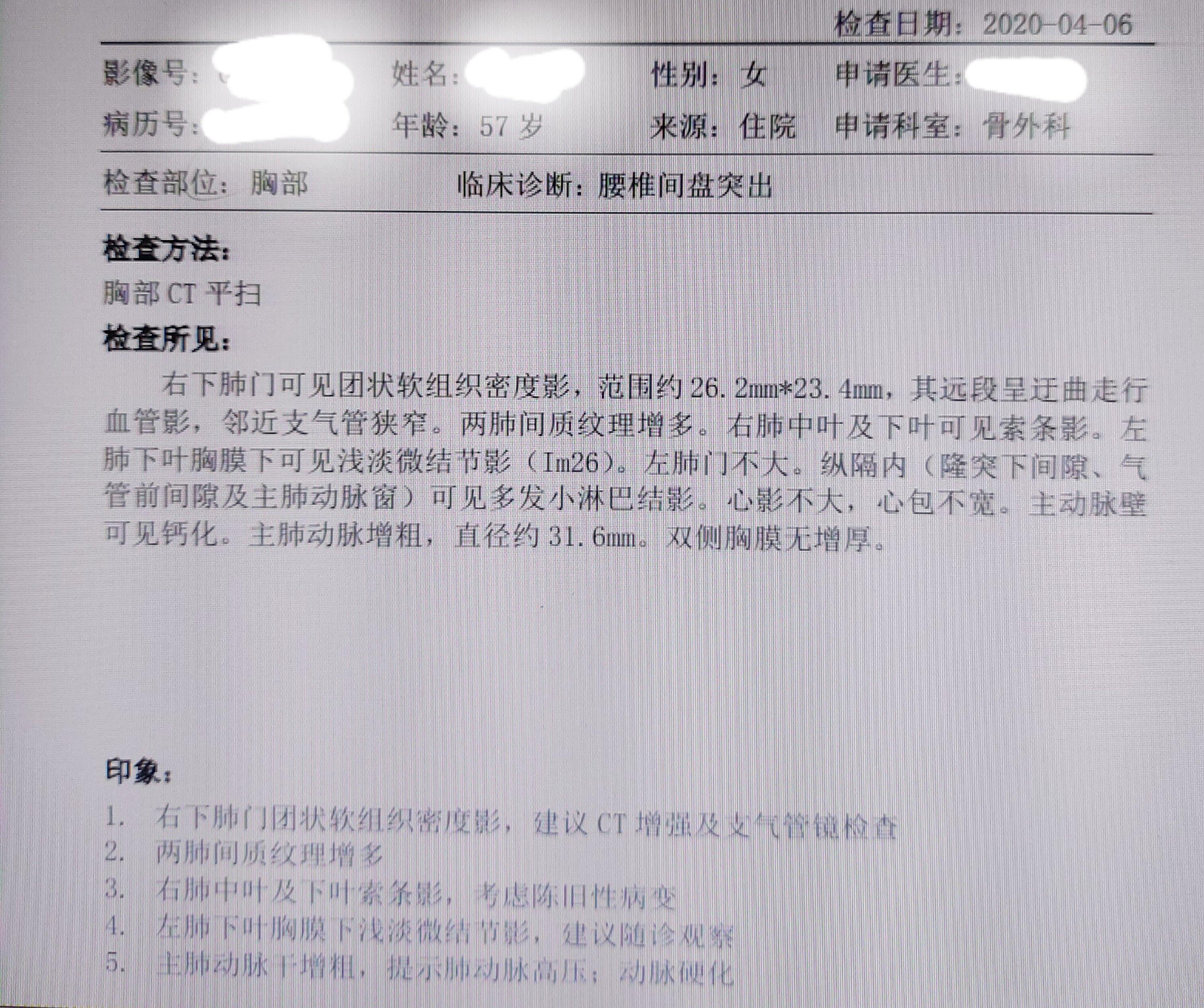 肺癌CT报告，比搞笑诺贝尔还搞笑！